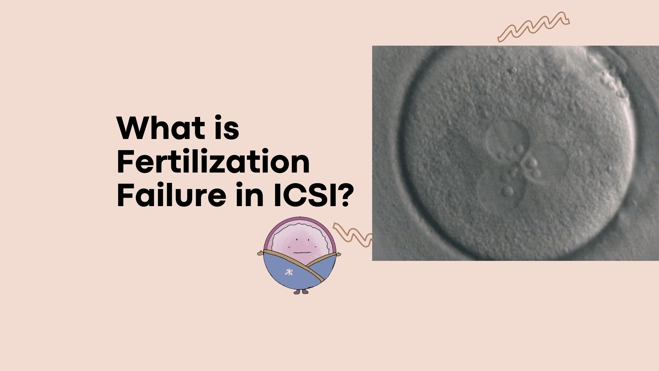 What causes fertilization failure in ICSI?