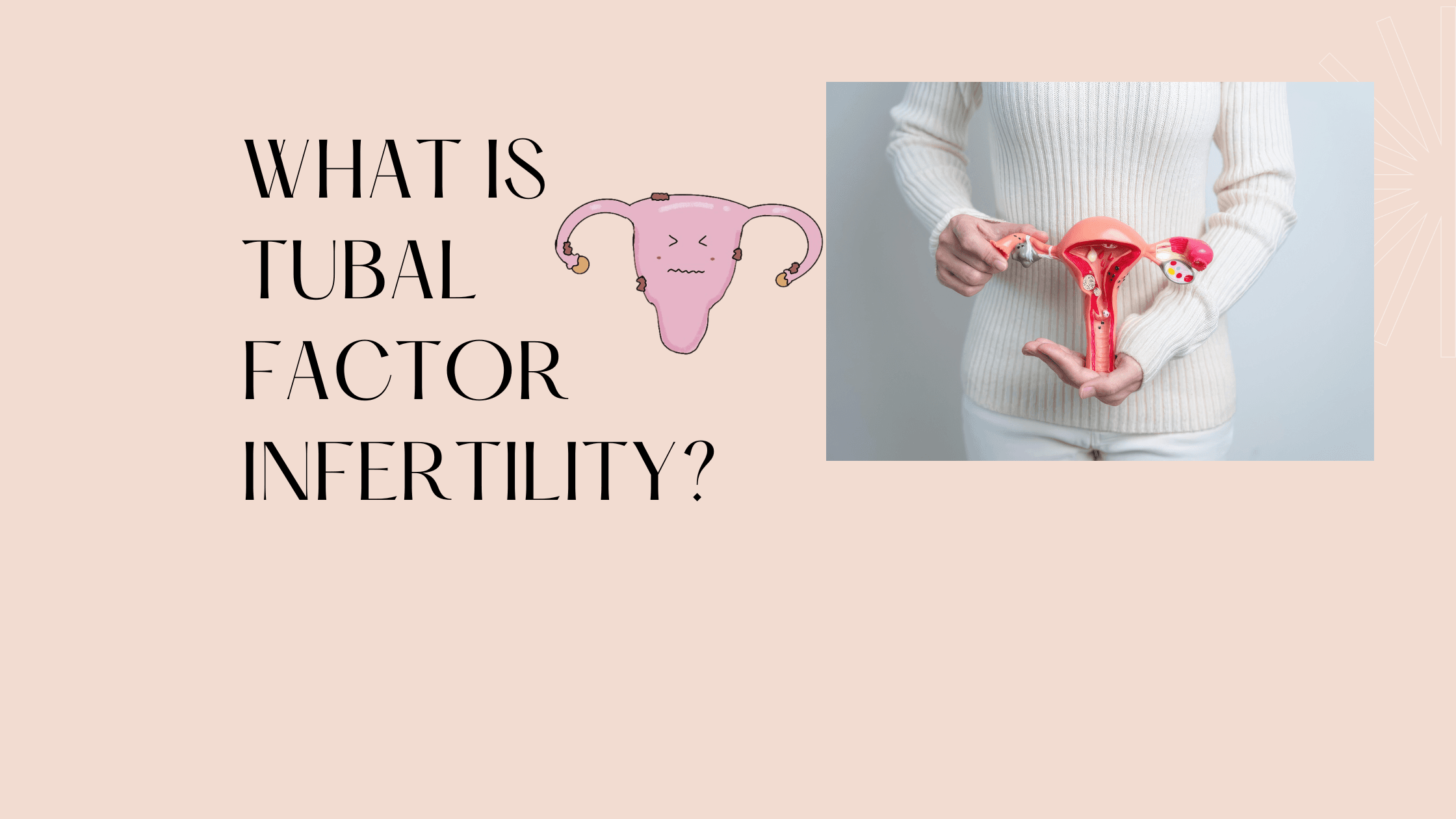 Tubal Factor Infertility: How to Diagnose and Treatment Options