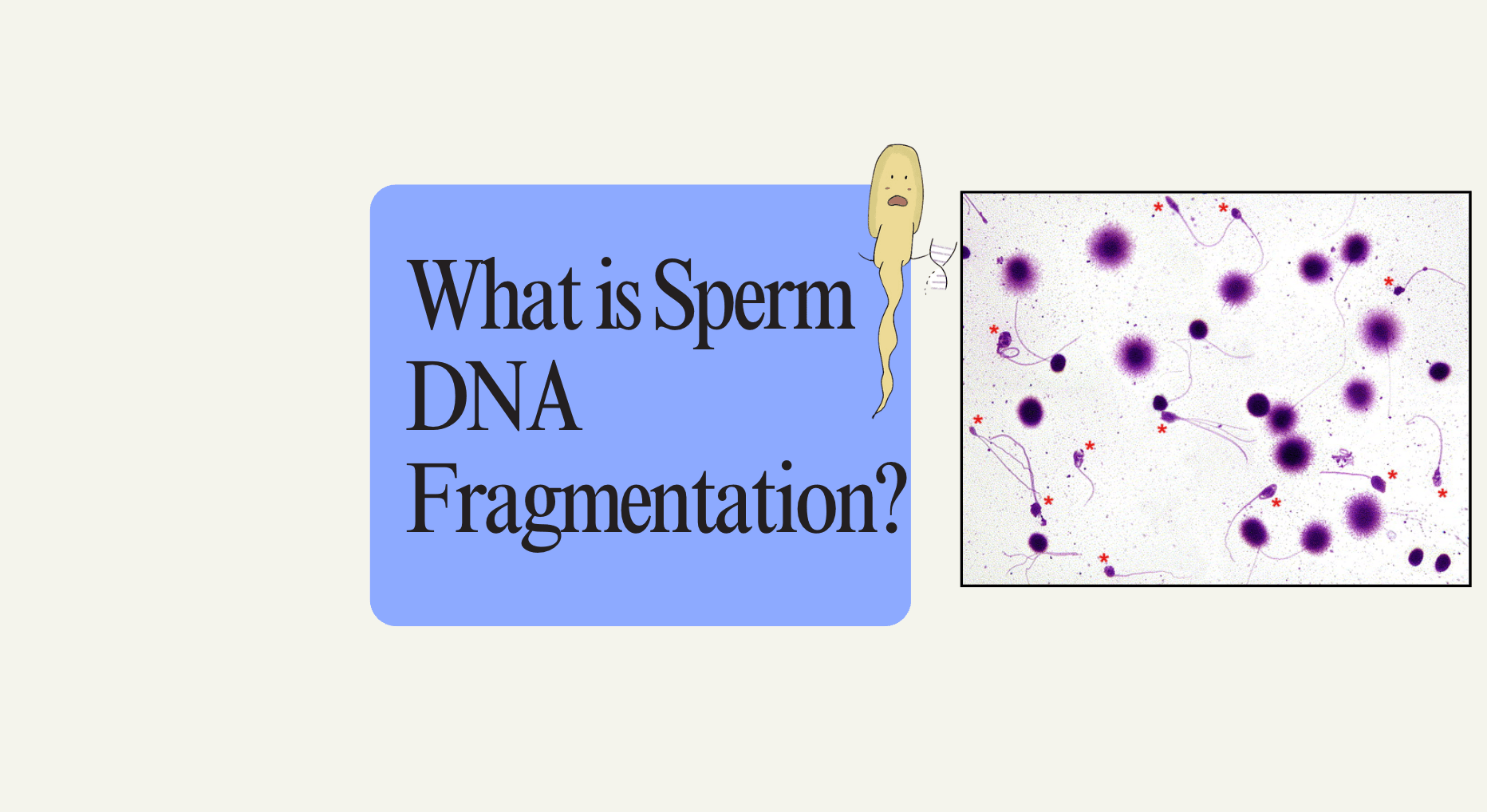 What Does Sperm DNA Fragmentation Mean? 