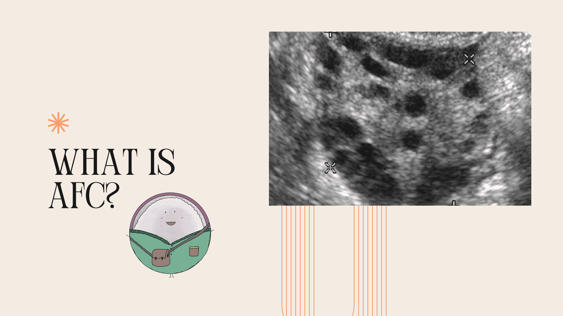 What is AFC? A Simple Guide for IVF Patients