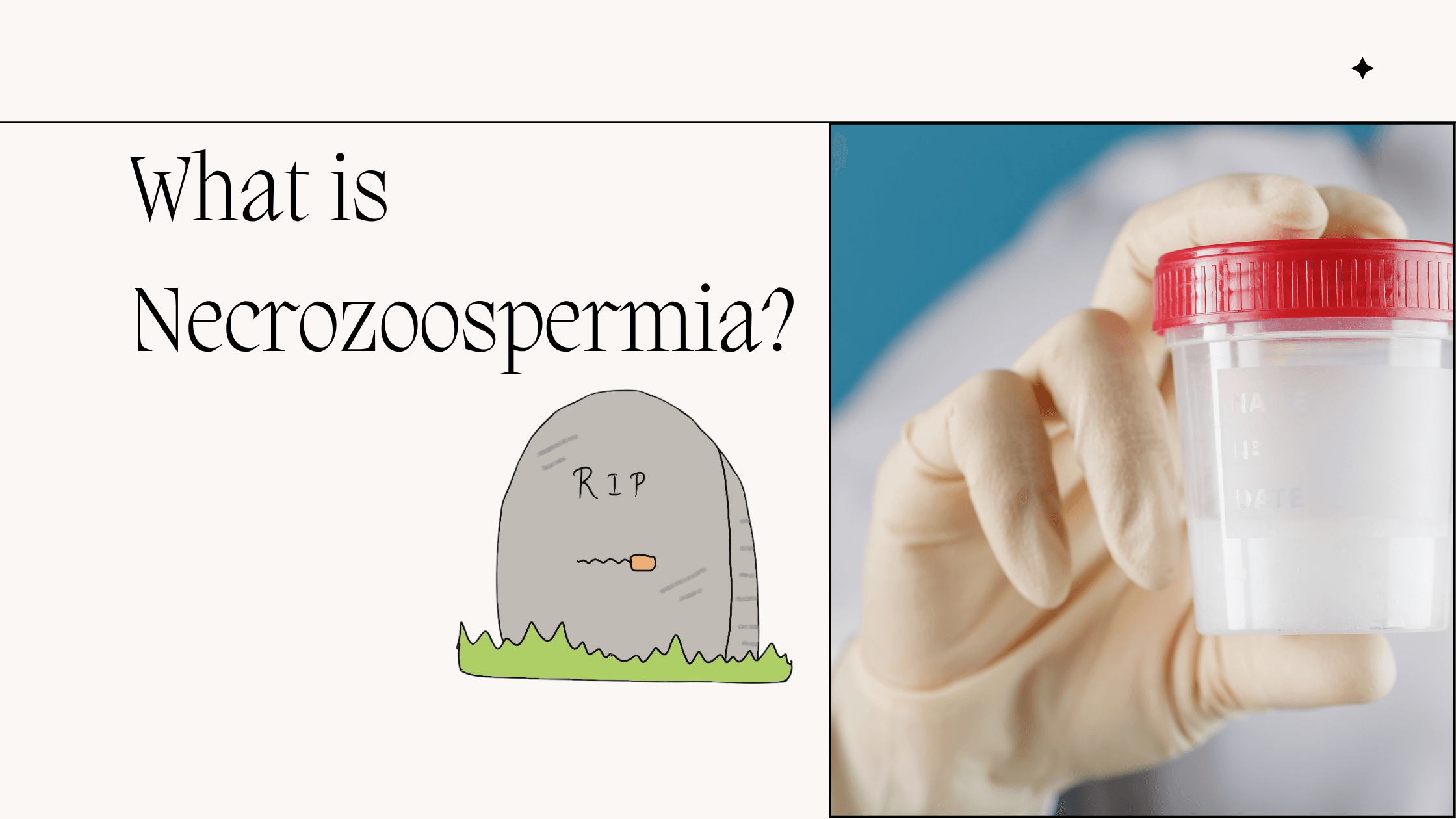 What is Necrozoospermia?
