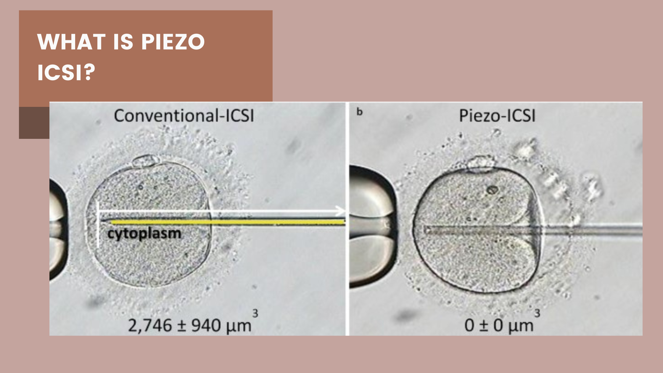 What is Piezo ICSI and how does it work?