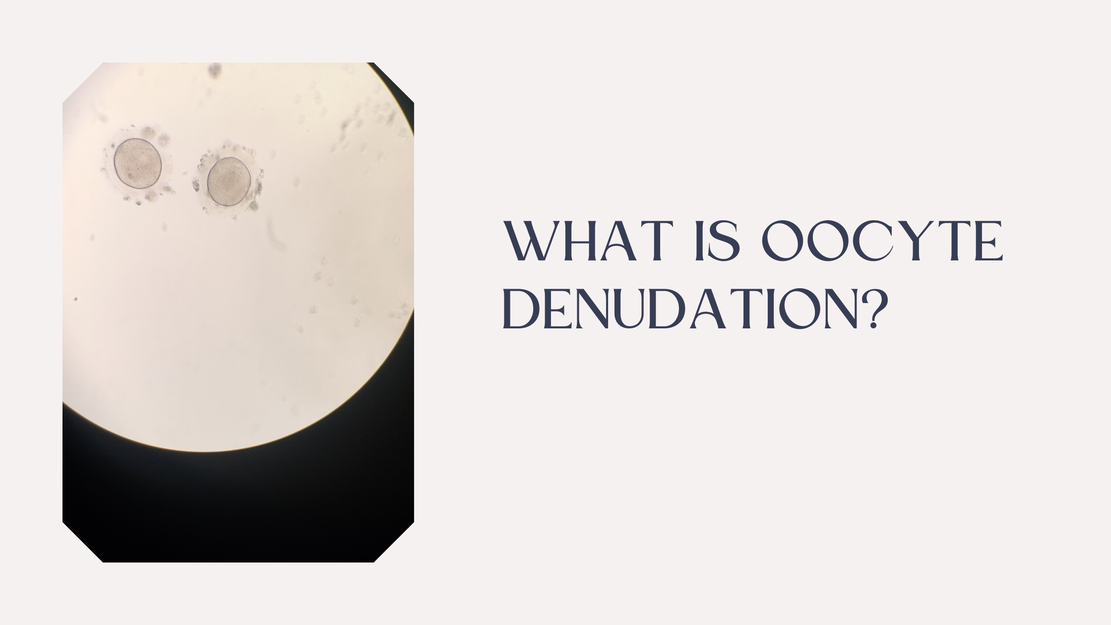 What is oocyte denudation?